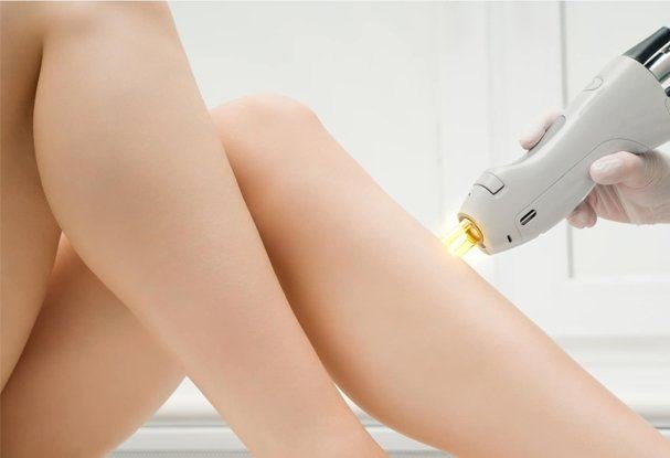 Laser vasculaire
